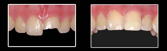 pre and postops